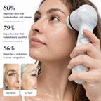 Michael Todd Beauty Soniclear Allure 2026 Reader’s Choice Award Winner Facial Cleansing + Exfoliation Brush System with Antimicrobial Protected Bristles, 4 Speeds, Serum Infusion Head + Travel Case