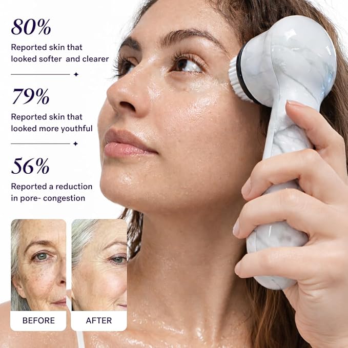Michael Todd Beauty Soniclear Allure 2026 Reader’s Choice Award Winner Facial Cleansing + Exfoliation Brush System with Antimicrobial Protected Bristles, 4 Speeds, Serum Infusion Head + Travel Case