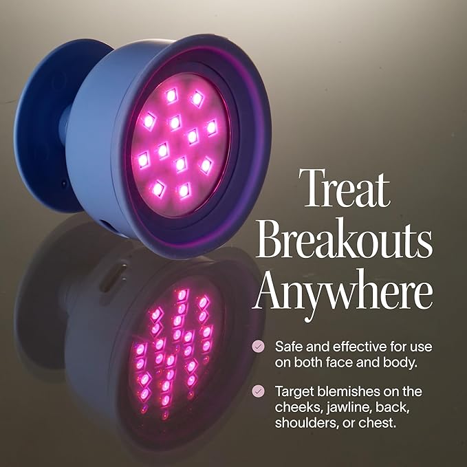 Solawave Bye Acne | Blue & Red Light Therapy Device for Face & Body | LED Face Wand Reduces Appearance of Redness, Pimples, Zits, & Blemishes | Calms Inflammation | 3-Min Treatment | Easy to Use