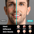 COSLUS FBS01 Facial Cleansing Brush Face Scrubber: Portable Silicone Waterproof Rechargeable Face Wash Brush, 5 Cleansing Modes, Electric Deep Cleaning for Men & Women, Removing Blackhead Exfoliating