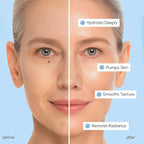 MAREE Hyaluronic Acid Toner Pads - Hydrating Face Wipes for Women Cleansing - Zero Pore Toning Brightening Exfoliating Face Pads - Pore Reducer Facial Peels - Acne Treatment Device