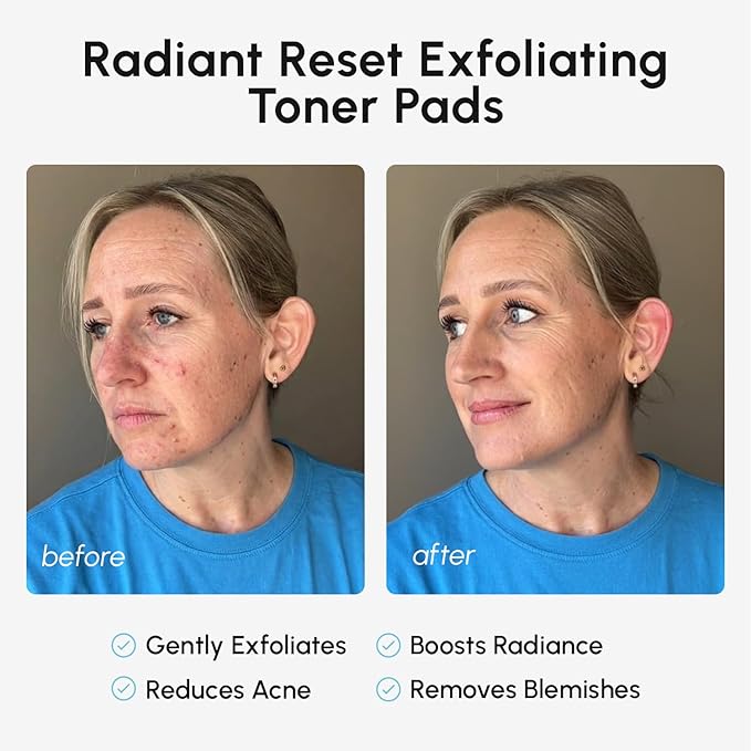 MAREE Glycolic Acid Pads – Toner Pads for Face Cleansing – Exfoliating Pad with Tea Tree Oil, Salicylic Acid & Vitamins E, B3, B5 – Acne Clearing, Skin Pore Resurfacing & Radiance Device - 80 Count