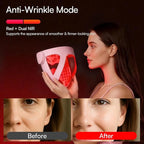 INIA Glow 4D Wireless Red Light Therapy Mask for face – Dual NIR, 320 LEDs, 4 Modes, Under-Eye Cooling, Cordless & Rechargeable LED Face Mask for Home & Travel, Skincare Gifts for Women Mom Wife, Pink