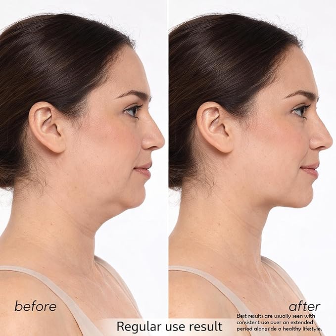 V-Face Machine and Electric Double Chin Device with 15 Gear Adjustable Intensities and 8 Modes – Intelligent Double Chin Machine for V-face. Free 3D Face Roller for Skin Care