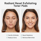 MAREE Glycolic Acid Resurfacing Pads - Toner Pads for Face Cleansing - Exfoliating Pad with Tea Tree Oil, Salicylic Acid & Vitamins E, B3, B5 - Acne Treatment Device for Pore Resurfacing - 50 Count