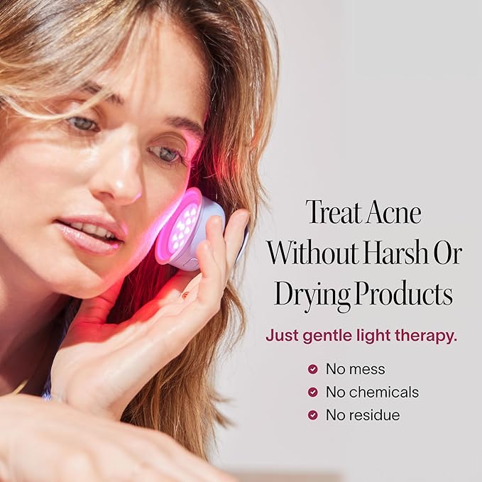 Solawave Bye Acne | Blue & Red Light Therapy Device for Face & Body | LED Face Wand Reduces Appearance of Redness, Pimples, Zits, & Blemishes | Calms Inflammation | 3-Min Treatment | Easy to Use