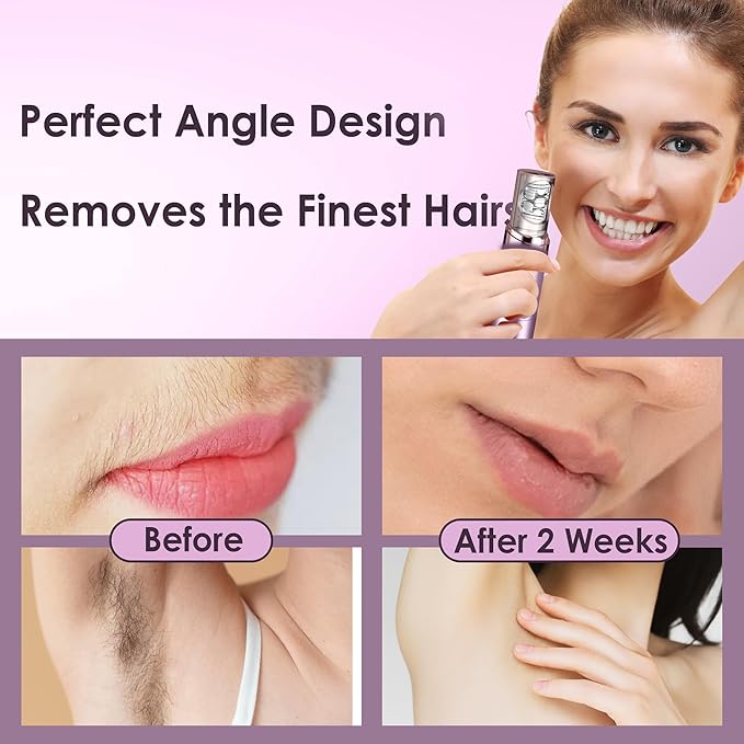 Hair Removal Epilator for Women, 2-in-1 Epilation System Device, Facial Hair Remover, Plucker for Face, Lip, 18 Carat Gold Plated Head, All Ages and Skin Types,with Pouch, Brush
