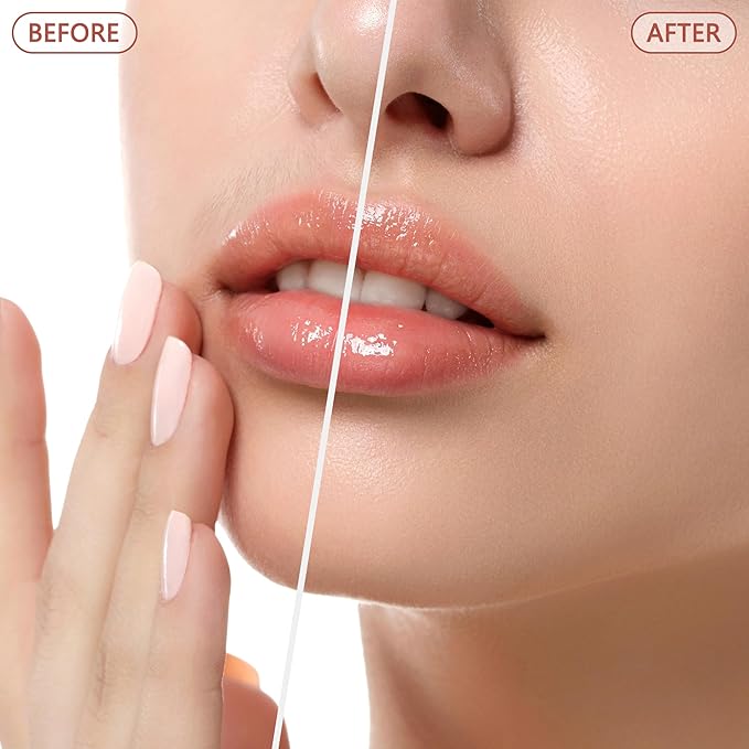 Facial Hair Remover for Women - as Seen on TV Painless Face Shaver - Electric Hair Removal Device for Face Lips Peach Fuzz with Light (White)