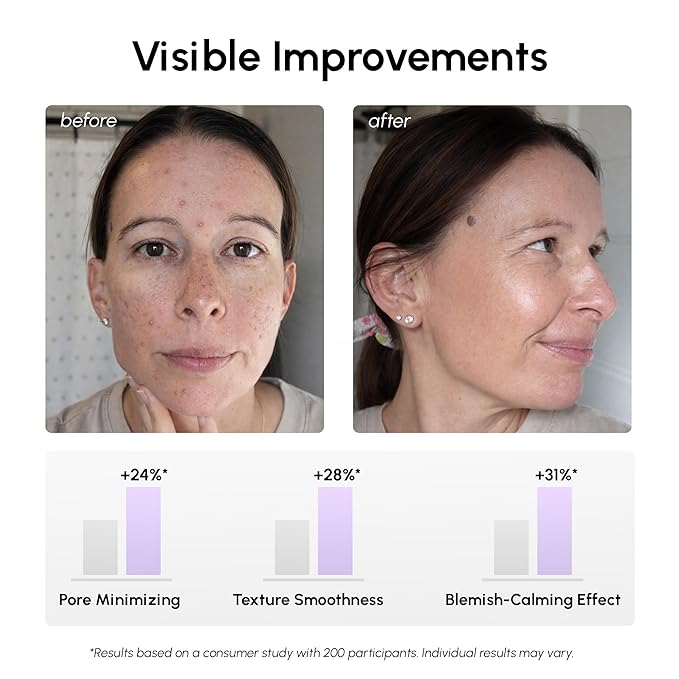 MAREE Niacinamide Toner Pads for Face – Exfoliating Pads with 12% Niacinamide, Salicylic Acid, Hyaluronic Acid & Tea Tree – Zero Pore, Uneven Skin Tone, Acne Clearing Facial Pads – Glow Up Device