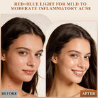 LED Light Therapy Mask for Face and Neck, Cordless & Rechargeable, Infrared,Red & Blue Light for Wrinkles and Acne Care, Full Coverage Skincare Device
