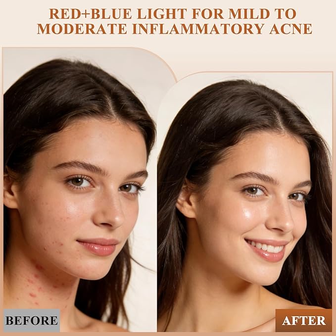 LED Light Therapy Mask for Face and Neck, Cordless & Rechargeable, Infrared,Red & Blue Light for Wrinkles and Acne Care, Full Coverage Skincare Device