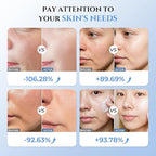 Microcurrent Facial Device - 5-in-1 Skin Tightening & Lifting Facial Machine - 5 Color Face Light Therapy Device - Professional Skin Care Tone Beauty Devices for Face, Neck, and Eye Area