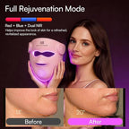 INIA Glow 4D Wireless Red Light Therapy Mask for face – Dual NIR, 320 LEDs, 4 Modes, Under-Eye Cooling, Cordless & Rechargeable LED Face Mask for Home & Travel, Skincare Gifts for Women Mom Wife, Pink